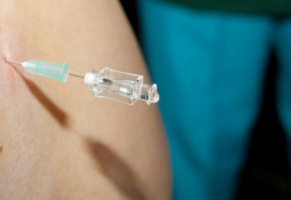 Epidural Steroid Injections