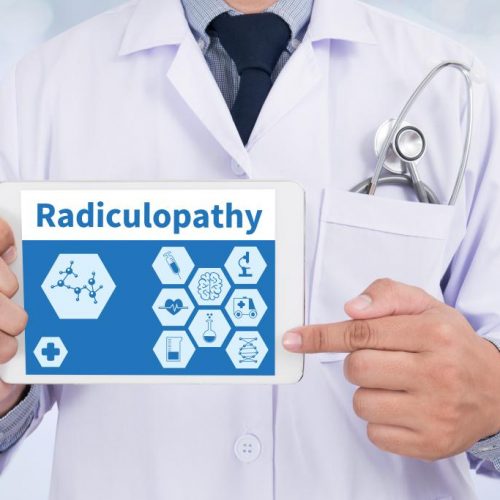 Lumbar Radiculopathy