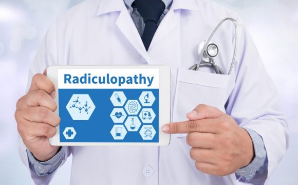 Lumbar Radiculopathy