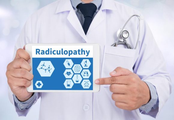 Lumbar Radiculopathy