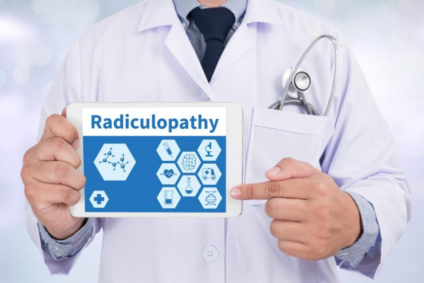 Lumbar Radiculopathy