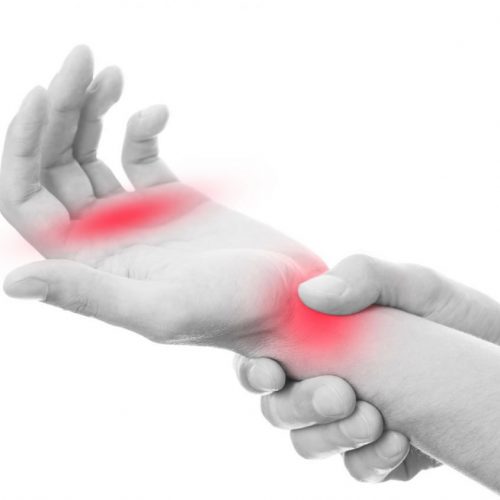 Complex Regional Pain- Syndrome (CRPS)